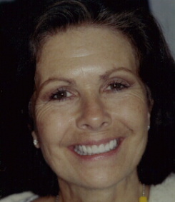 Picture of Cielle with porcelain veneers