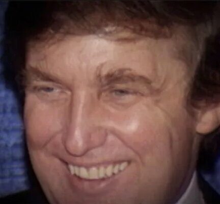 A head shot of Donald Trump before his smile makeover