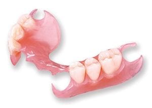 photograph of a removable partial denture replacing three back teeth on each side of the mouth, made entirely of plastic
