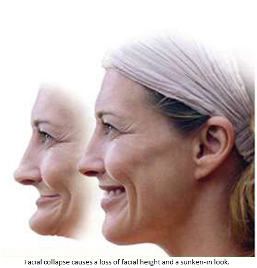 ClearChoice screwed up my face - Cosmetic Dentistry Blog