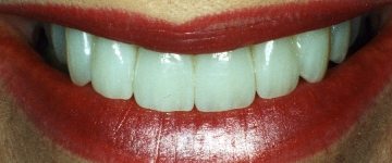 An expert cosmetic dentist example
