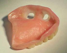 cu-sil partial denture